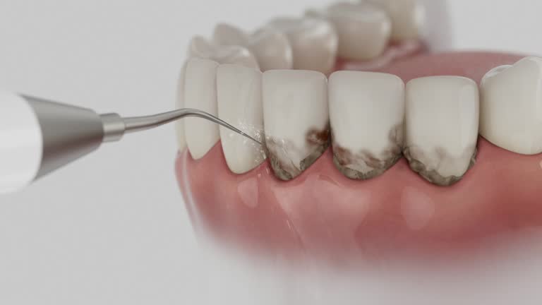 Trusted Invisalign Clear Aligners service in Lake of the Woods, IL - Dentist Open Now